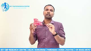 Supramalleolar Orthosis (SMO) क्या है? जानिए इसके फायदे और उपयोग screenshot 2