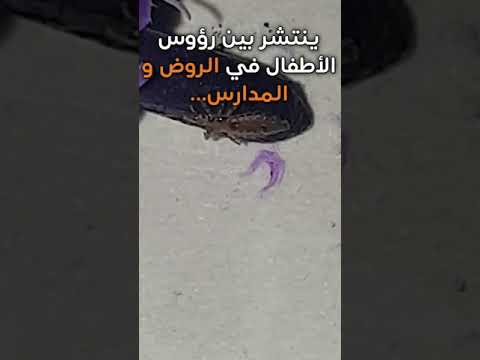 ماتخلعيش من القمل و الصيبان اليك حيلة سهلة تخلصك منه بلا رجعة