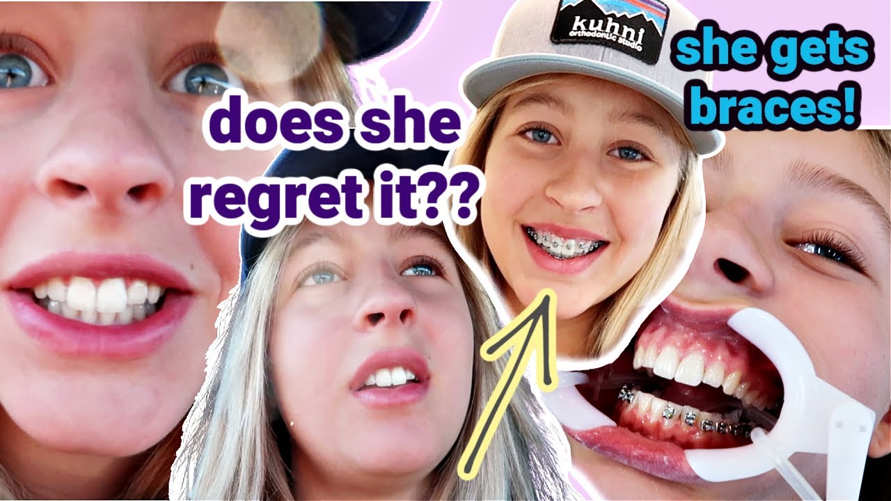 AMANDA GETS BRACES!! does she regret it??