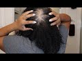 Chit Chat on thinning hair/wash day using The Doux