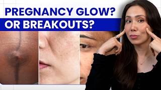 Why Pregnancy Transforms Your Skin (Hormones, Glow & Breakouts Explained)