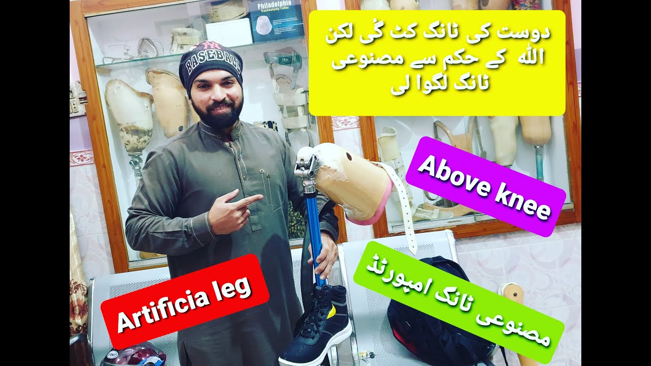 Above knee Artificial leg Imported systam  free knee joint 