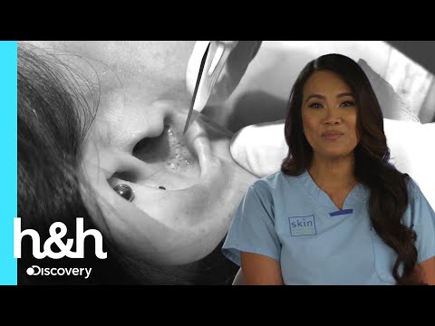 Video: Cómo quitar la obstrucción del oído interno o la 