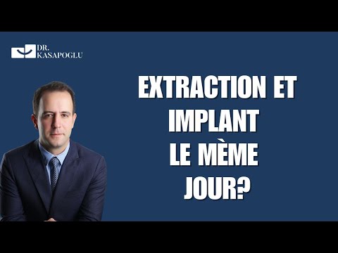Extraction et implant le même jour : Bonne idée ou erreur ?
