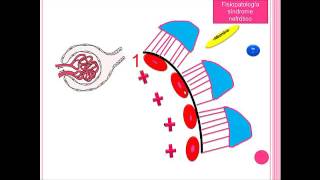 Venosa trombosis renal nefrótico síndrome