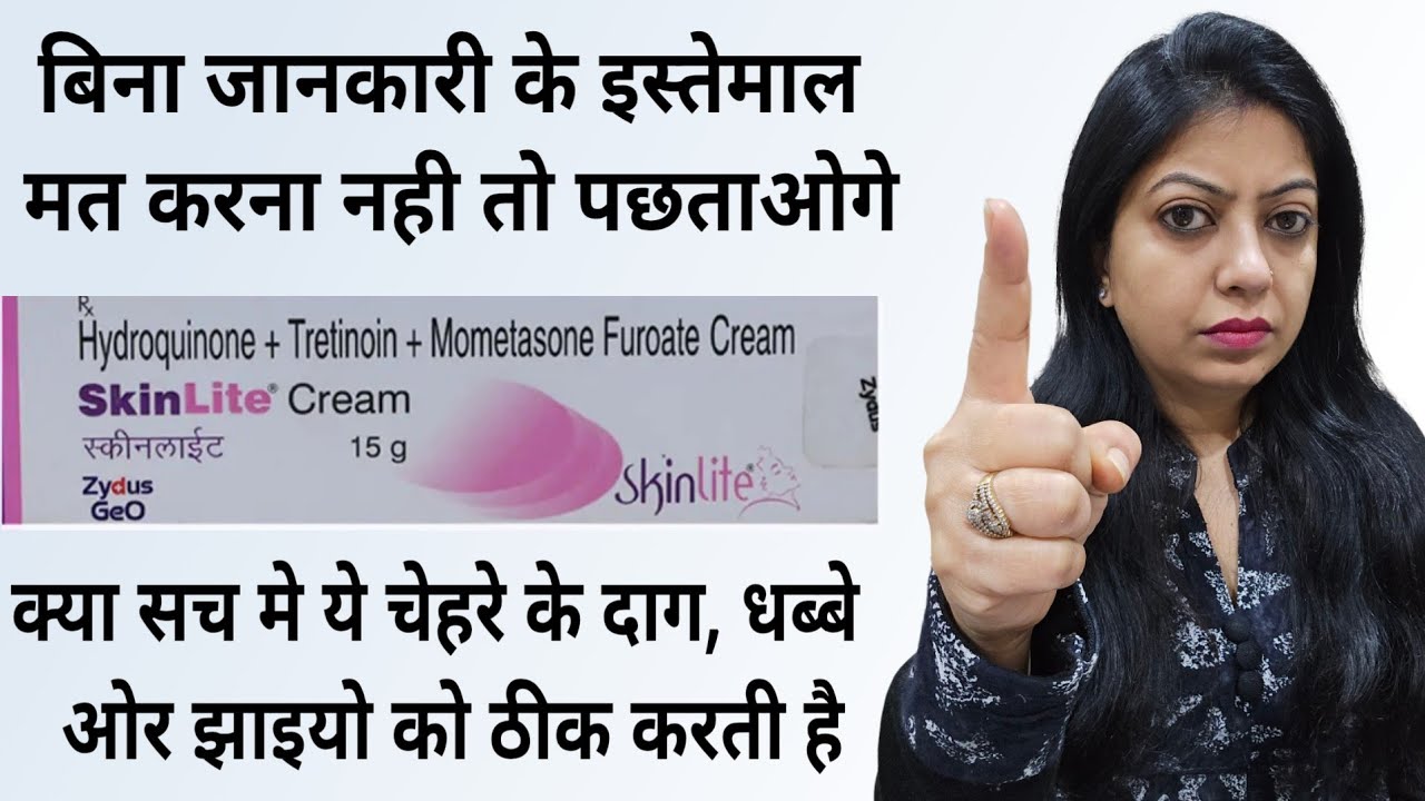 SkinLite Cream // Review 