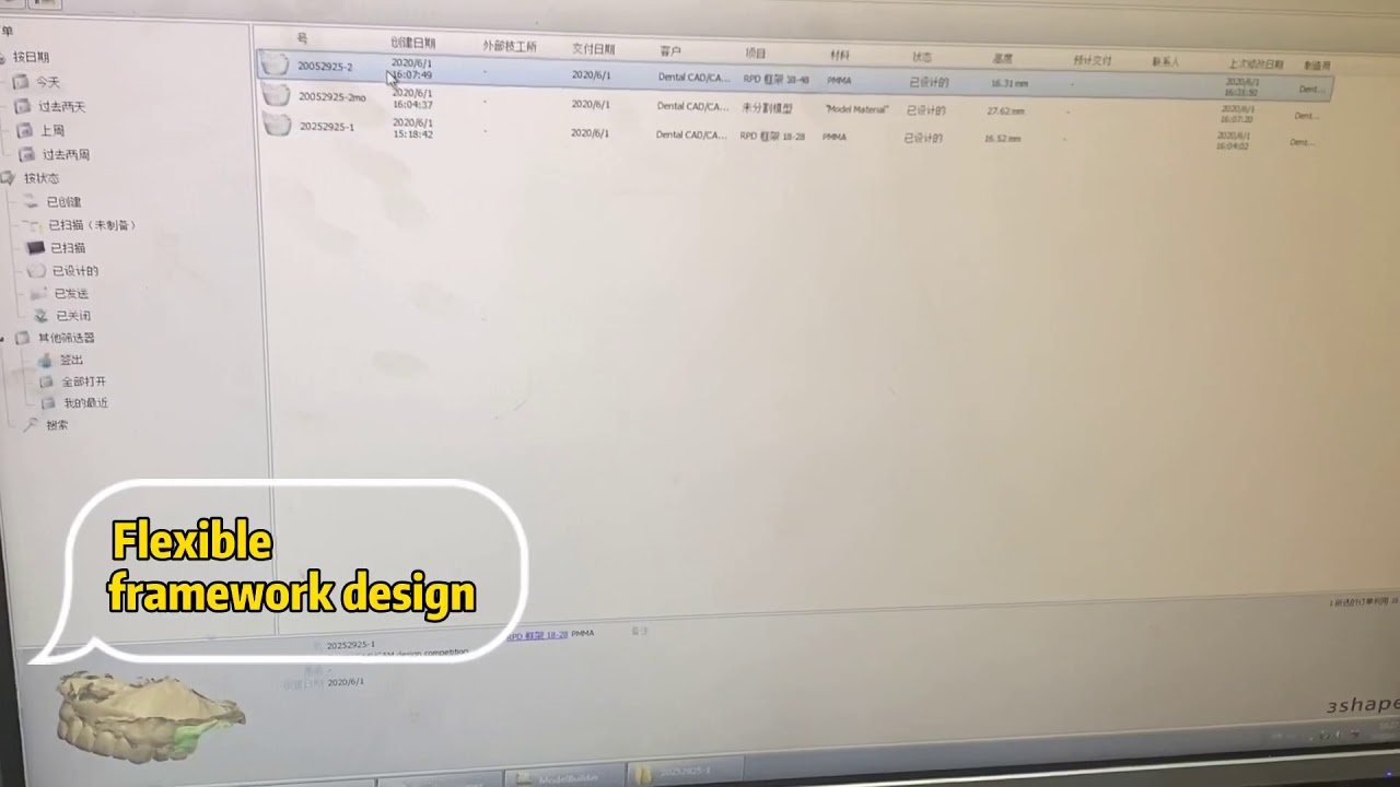 Cad/cam removable partial framework - YouTube