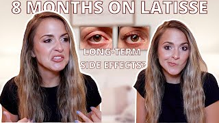 8 MONTH LATISSE RESULTS: how to maintain results & conserve product| any long lasting side effects?