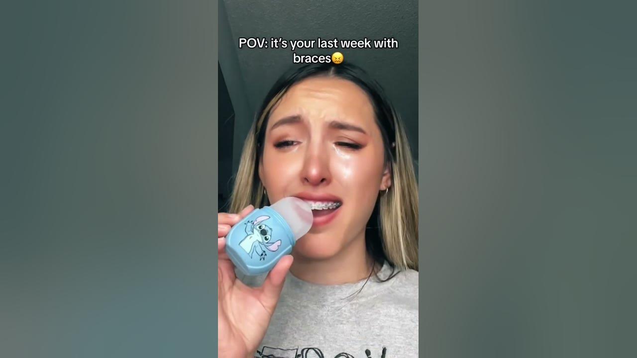 So much painnnn #autumnmonique #braces #youtubeshorts