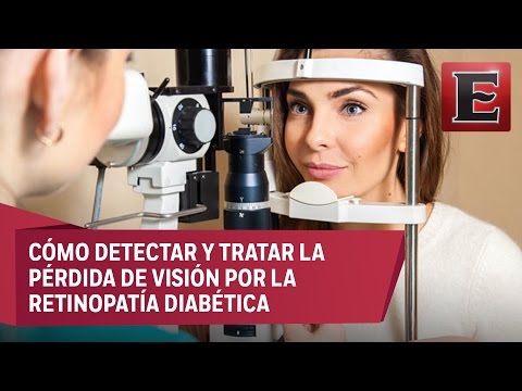 Video: ¿Cuánto cuesta un examen de la vista para diabéticos?