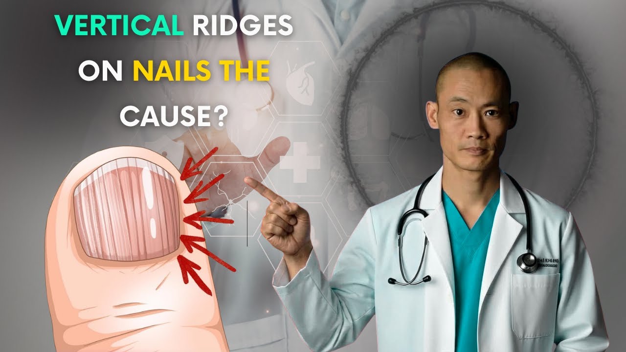 The REAL Causes of VERTICAL RIDGES On Your Nails l shi heng yi