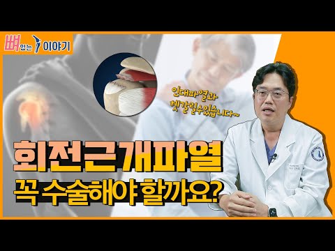 회전근개파열 원인과 치료법 / 힘줄 파열은 수술밖에 답이 없다?