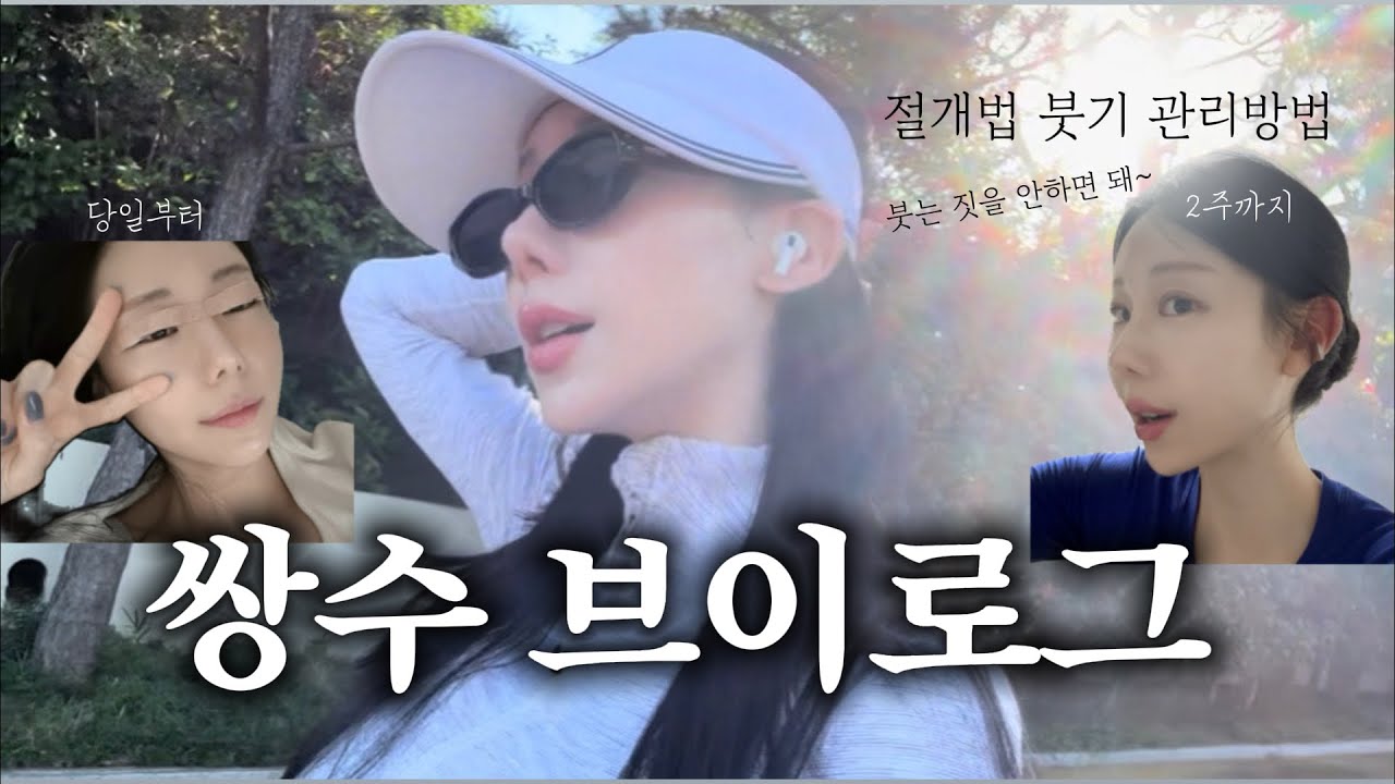 [VLOG] 쌍수브이로그 | 쌍커플수술후기 | 쌍커플절개법 | 2주만에 붓기빼는법