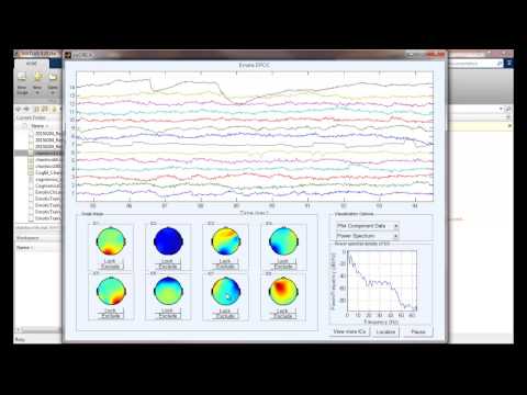 Part 3 and 3-1 -  Real-time EEG Source Imaging - Eye Activities and Occipital Alpha