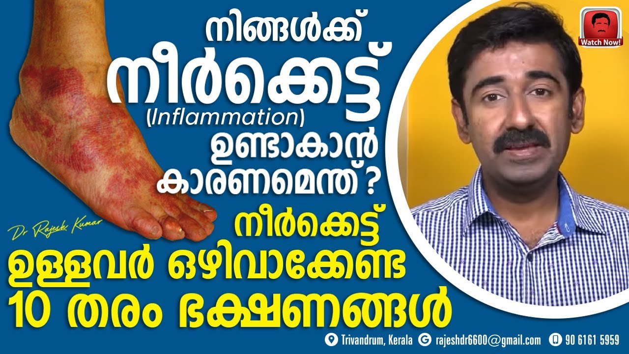 Что вызывает отёки? Какие продукты следует употреблять и избегать при отёках