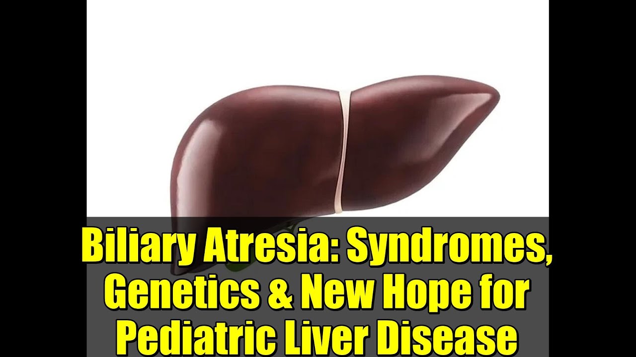 Атрезия желчных протоков: синдромы, генетика и новая надежда на лечение заболеваний печени у детей