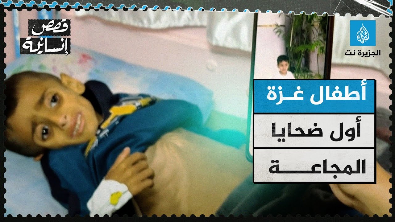 أجساد هزيلة وأعين غائرة.. أطفال غزة أول ضحايا المجاعة