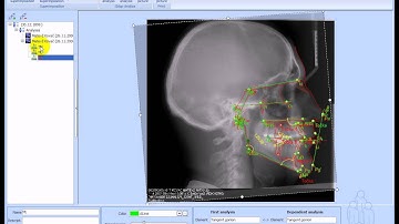 Ax.CEPH Superimposition