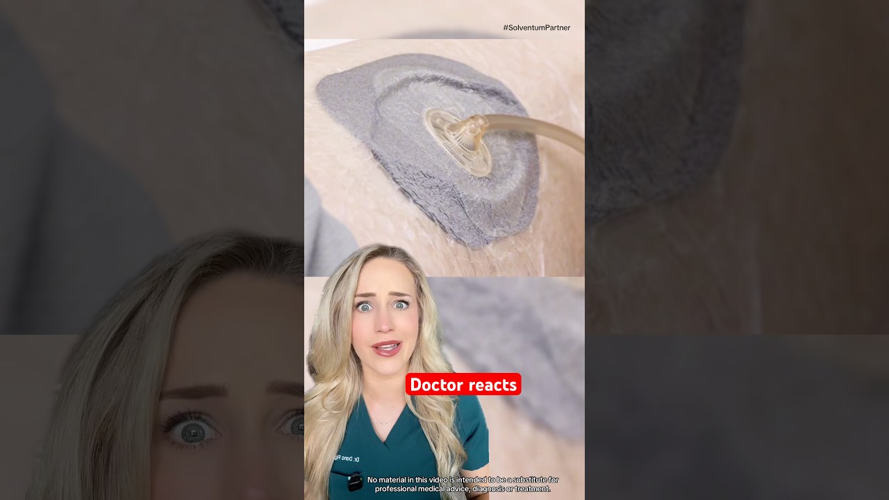 #sponsored Curious how negative pressure wound therapy, aka V.A.C.&reg; Therapy actually works?