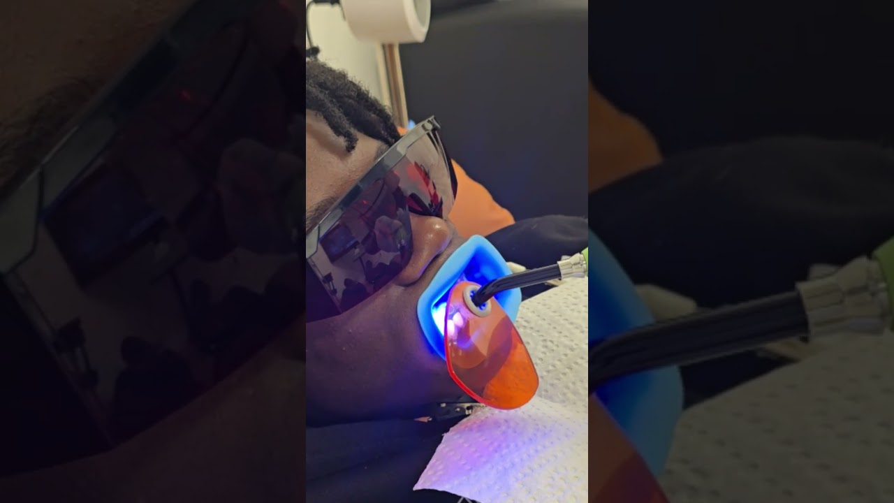 how to apply and remove tooth gems