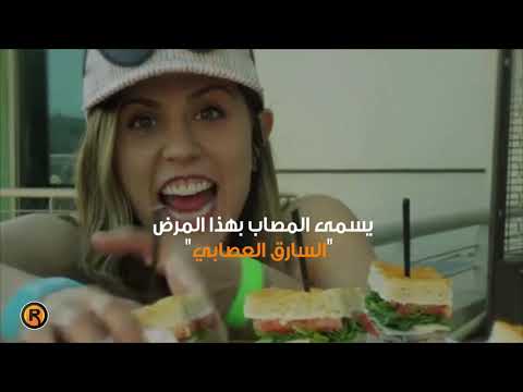 الكلبتومانيا مرض نفسي المصاب به لا يقاوم السرقة