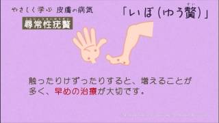 やさしく学ぶ－皮膚の病気　いぼ（疣贅）