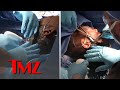 Tessica Brown Gets Gorilla Glue Out of Hair, Video of Surgery | TMZ