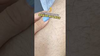 My Honest Lazer Hair Removal Journey
