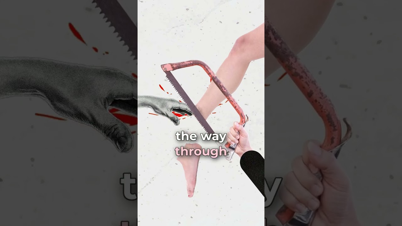 The 300% Fatal Surgery 