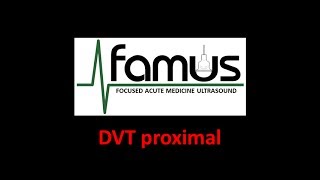 De superficial dvt tromboflebitis