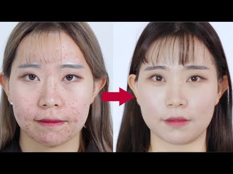 [MEDICUBE SG] Products for acne-prone skin