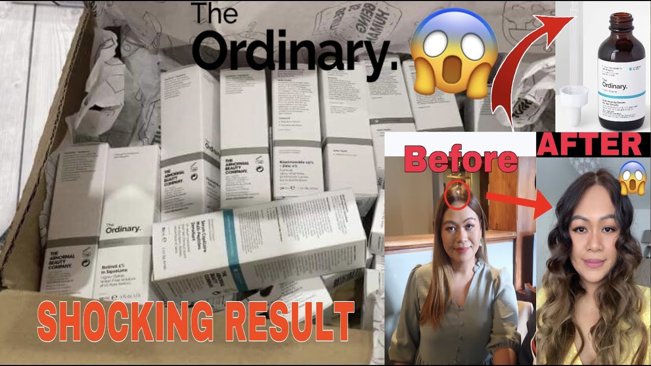 £150 THE ORDINARY SKINCARE HAUL | MY HAIR IMPROVED 😱