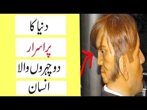 Edward Mordrake The Man With 2 Faces || Horrible Life Of A Man With Two Faces || Adbi Diary
