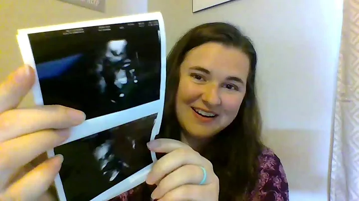 My Pregnancy and Birth Story (Dax)