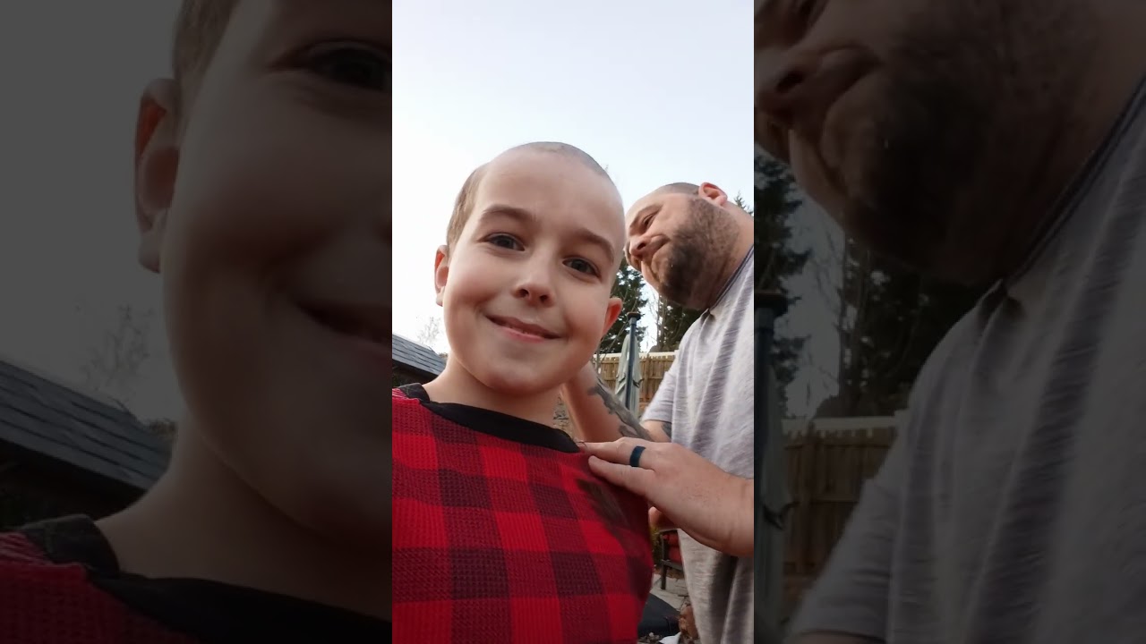 I went bald for no reason