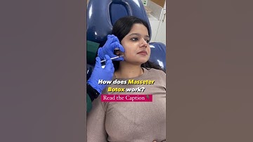 "Transformative beauty: Masseter Botox redefines facial proportions by relaxing the jaw muscles."