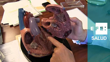 ¿Cómo saber si tiene una válvula permeable en el corazón?