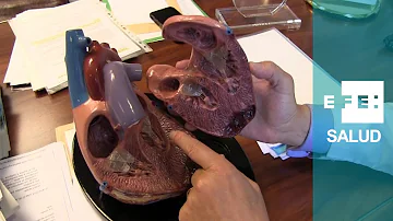 ¿Se puede vivir con una válvula cardíaca obstruida?