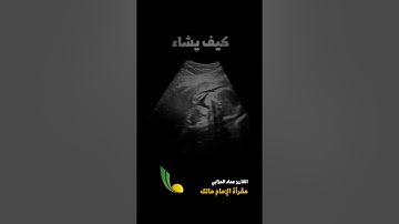 تلاوة خاشعة وهادئة مختارة من سورة آل عمران || إِنَّ اللَّهَ لَا يَخْفَىٰ عَلَيْهِ شَيْءٌ