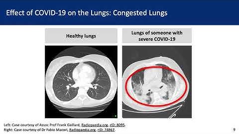 Natural History of SARS-CoV-2​