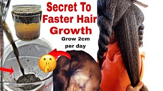 No Joke! Overnight Hair Growth Treatment! How I Grew My Hair Extremely Fast😱 |grow 2cm Hair Per Day