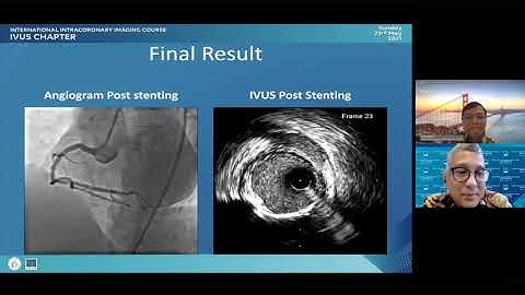 International Intracoronary Imaging Course - IVUS Chapter (Vu Hoang Vu, MD)