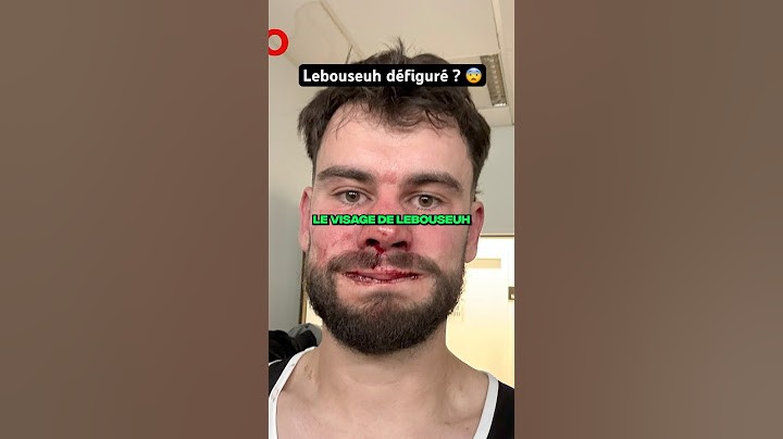 LEBOUSEUH DÉFIGURÉE APRÈS SON COMBAT A DTR 😨 #shorts #lebouseuh #dtr #tiktok #prime
