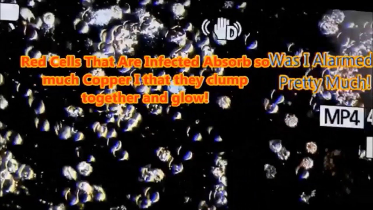 BEATING LYME DISEASE. REAL DEMONSTRATION. YouTube