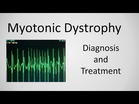 Video: Systematické Vyšetření štítné žlázy U Myotonické Dystrofie: Souvislost Mezi Objemem štítné žlázy A Inzulínovou Rezistencí