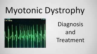 Myotonic Dystrophy Diagnosis and Treatment explained