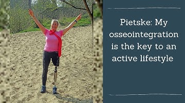 Osseointegration as a key to an active lifestyle