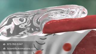 Coseal Resorption - MOA Animation