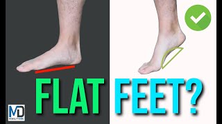 Flexible vs Rigid Flat Feet: Know the Difference