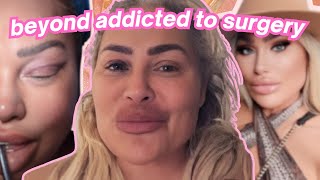 Darcey & Stacey Get ANOTHER Facelift | Recent Plastic Surgery